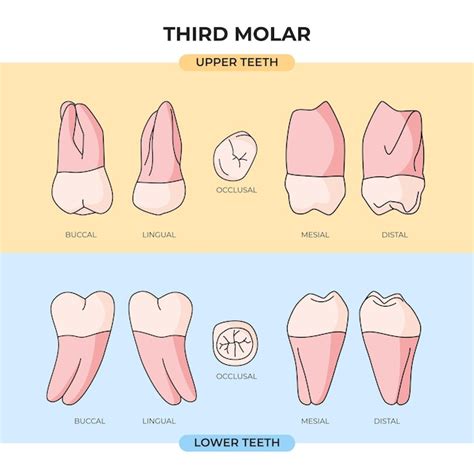 3Rd Molar Teeth