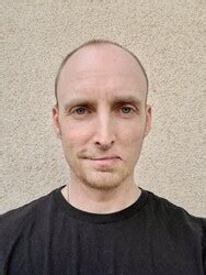 Chad Kultgen Face Surgery