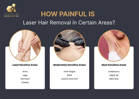 Does Laser Hair Removal Hurt