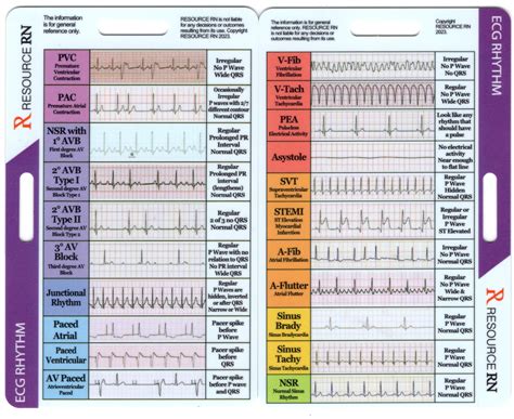 Ekg Strips
