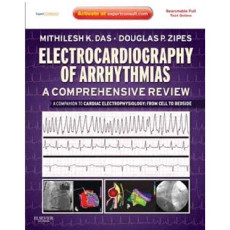 Electrocardiography Of Arrhythmias