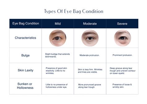 Eye Bags Types
