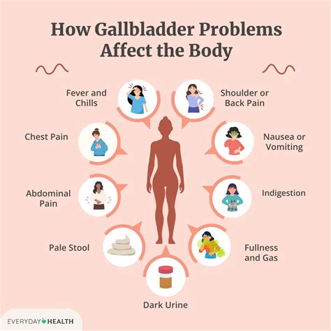 Gallbladder Problem Symptoms