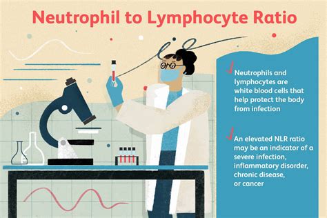High Lymphocytes Low Neutrophils