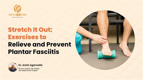 How To Prevent Plantar Fasciitis