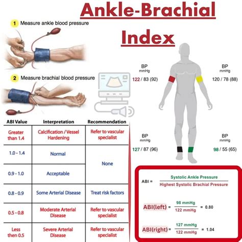 Index Ankle Brachial Test