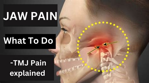 Jaw Discomfort Causes