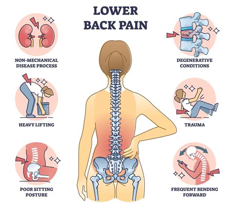 Lower Back Pain During Running