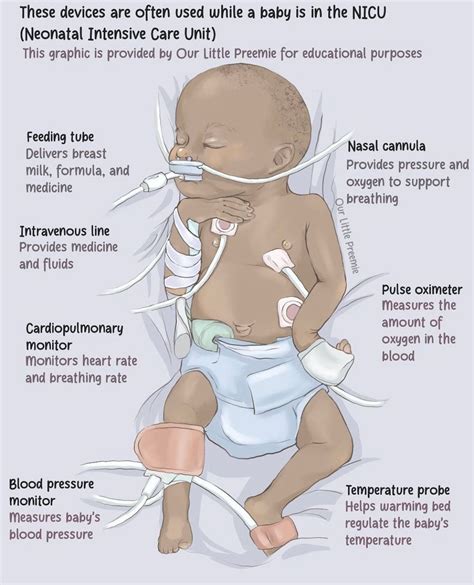 Nicu Definition