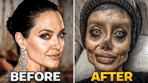 Plastic Surgery Gone Wrong Face