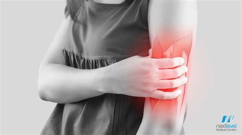 Pulled Muscle In Arm