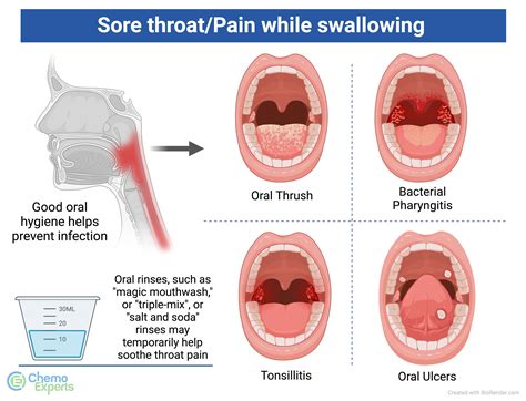 Sore Throat In Left Side