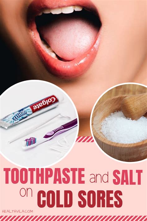 Toothpaste On Cold Sore