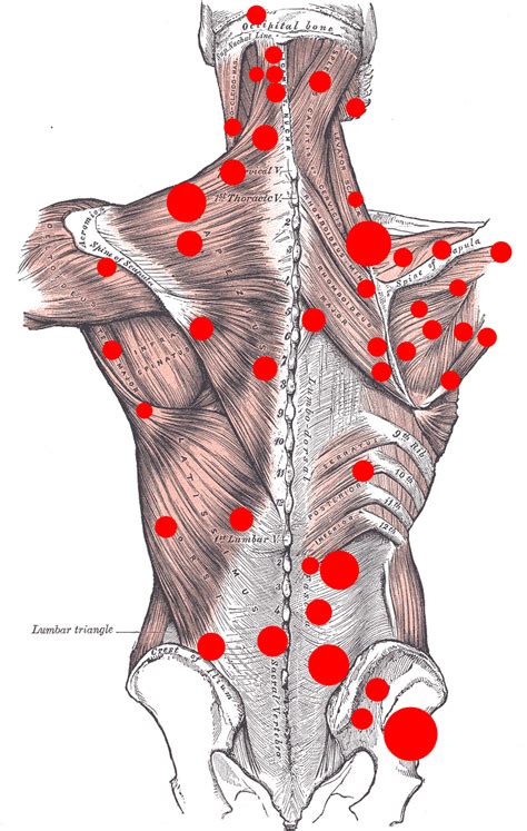 Trigger Points In Back