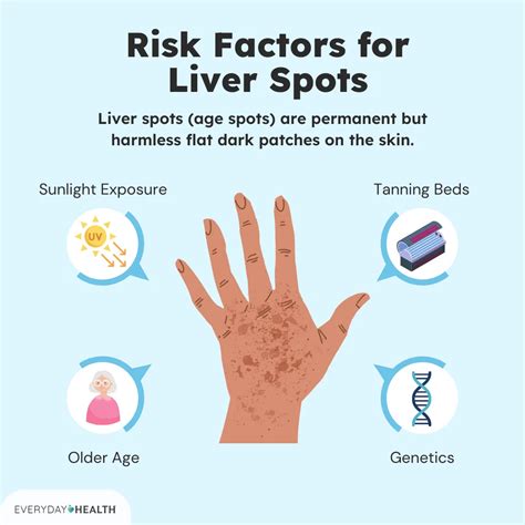 What Causes Liver Spots