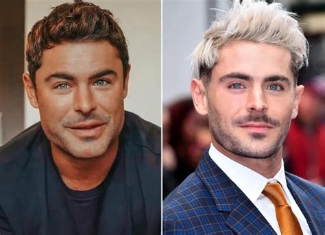 Zac Efron Face Plastic Surgery Video